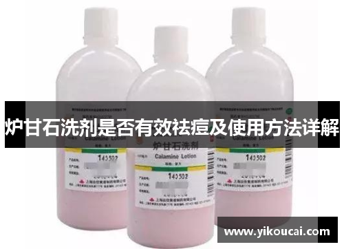 炉甘石洗剂是否有效祛痘及使用方法详解